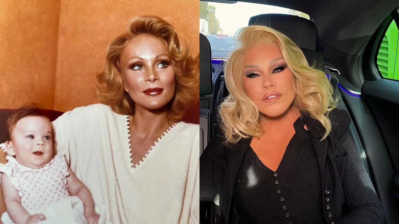 Jocelyn Wildenstein neden öldü? Kimdir?