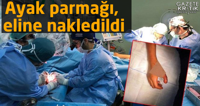 Ayak parmağı, eline nakledildi